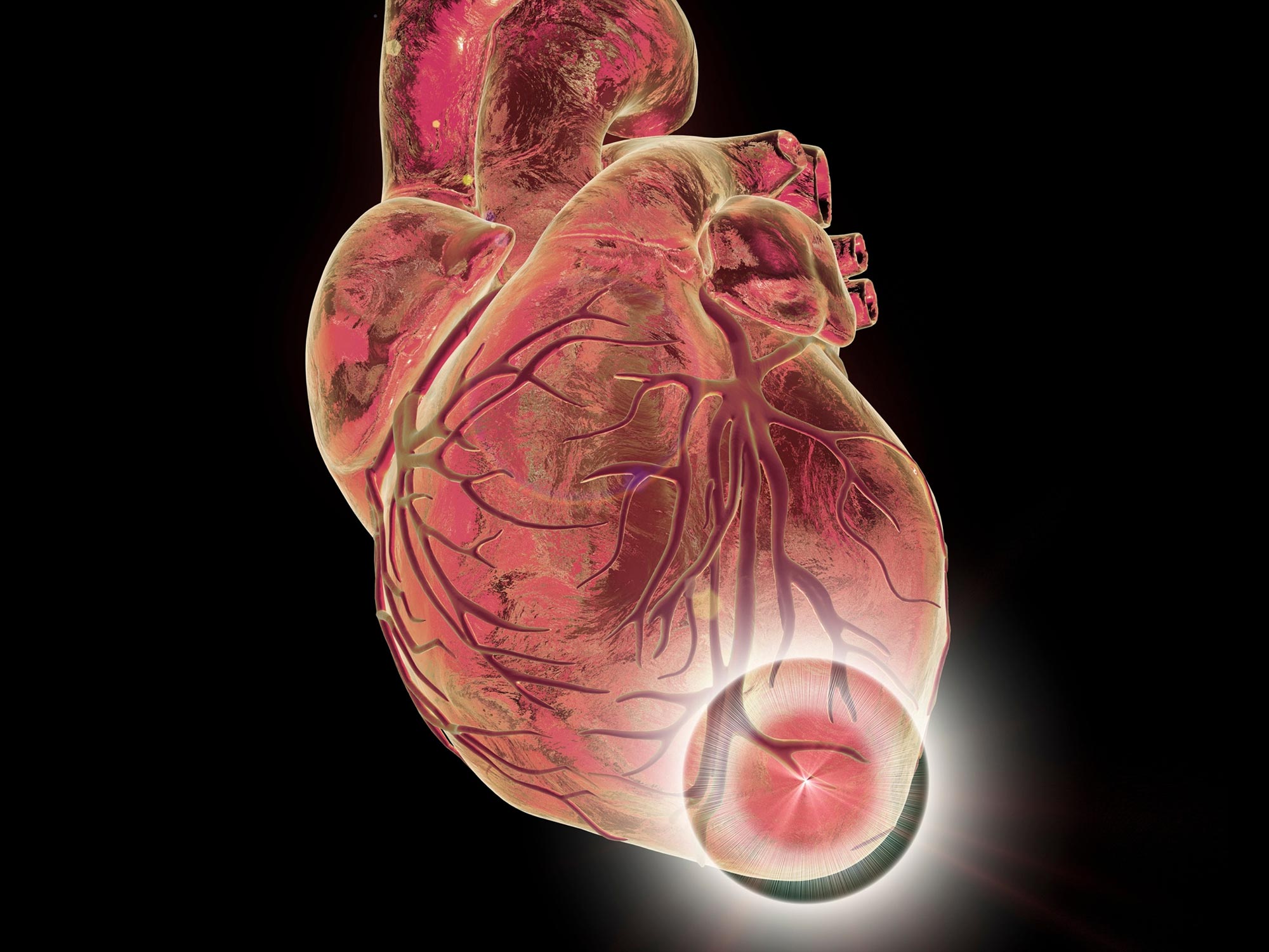 COVID-19 Infections Increase Risk of Serious Heart Conditions Up to a Year Later